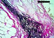 maintain lipoprotein levels at values consistent with those seen in wild-type mice.