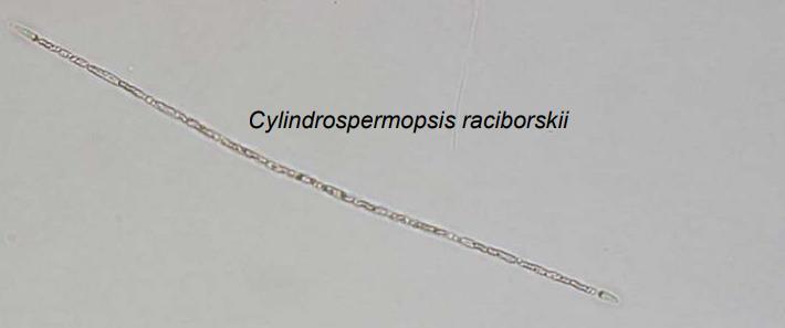 Tropická sinice Cylindrospermopsis