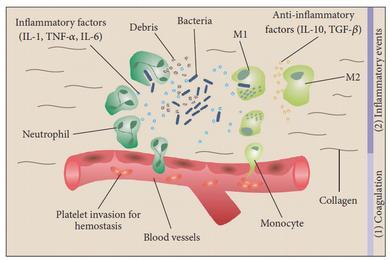 1. INFLAMACE (+ HEMOSTÁZA) Infiltrace neutrofily (útok na mikroby a rozpadlé buňky) Infiltrace monocyty s přeměnou na makrofágy (produkce cytokinů, likvidace apoptotických buněk včetně neutrofilů)