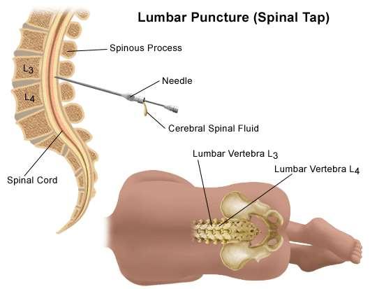 http://www.hopkinsmedicine.