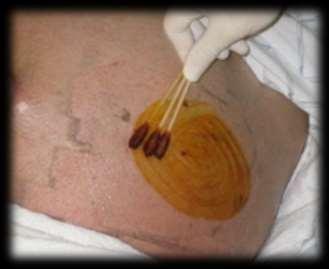 HODNOCENÍ VZORKU - MNOŽSTVÍ, BARVA, HUSTOTA RIVALOVA ZKOUŠKA http://img.medscape.
