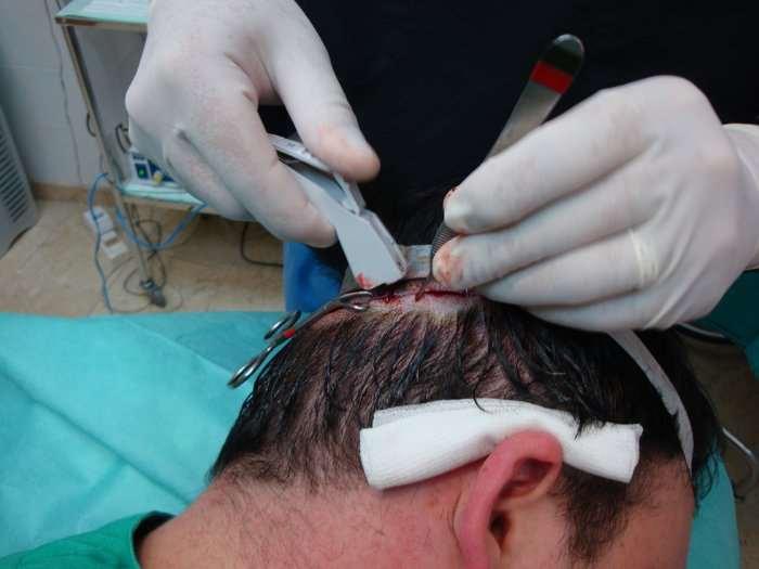 http://www.actasdermo.
