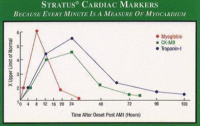 Příloha 6: Elevace srdečních markerů Zdroj: