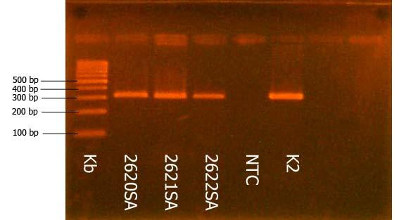 sérií vyšetřovaných vzorků je použit i velikostní standard (Kb), který je komerčně dodávanou směsí DNA fragmentů o předem známé velikosti, který na gelu vytváří pruhy označované jako ladder neboli