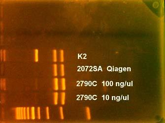 S každou sérií vzorků je vyšetřována také interní kontrola (K2) o předem známém genotypu obsahující stanovovanou mutaci v heterozygotní formě (WT/MUT), která byla v minulosti vyšetřena dvěma