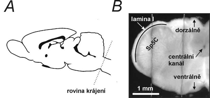 4. Materiál a metody Pokusy jsme prováděli na neuronech v akutně připravených řízcích nervové tkáně (pyramidové neurony vrstvy II/III neokortexu a neurony lamina I kaudální části trigeminálního