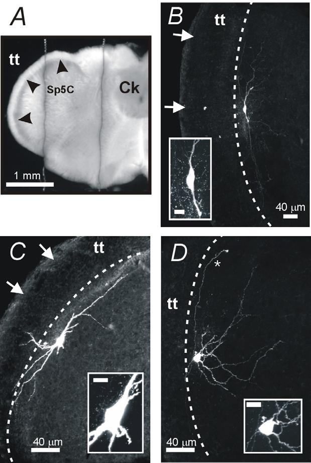 Obrázek 5.19. Morfologie neuronů lamina I Sp5C značených komplexem Streptavidin-Alexa 488 v akutním tkáňovém řízku mozkovým kmenem.