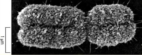 Eukaryontní chromozomy: - umístěny vždy v jádře eukaryontních buněk (tedy i lidských), které je oddělené membránou - jejich morfologie pozorovaná světelným mikroskopem závisí na tom, v jakém stádiu