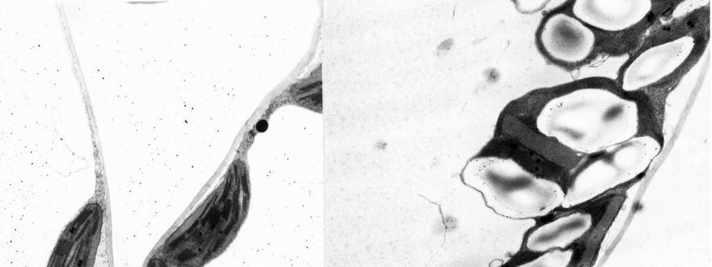 Obr. 2.4 Chloroplasty v mezofylových buňkách tabáku planého (Nicotiana sylvestris) rostoucího při A stávající a B zvýšené koncentraci CO2.