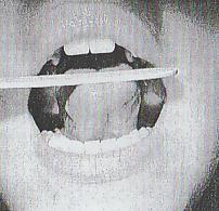 Obrázek 12: Špátle příčně přes jazyk (převzato z: Kittel, 1999, s.