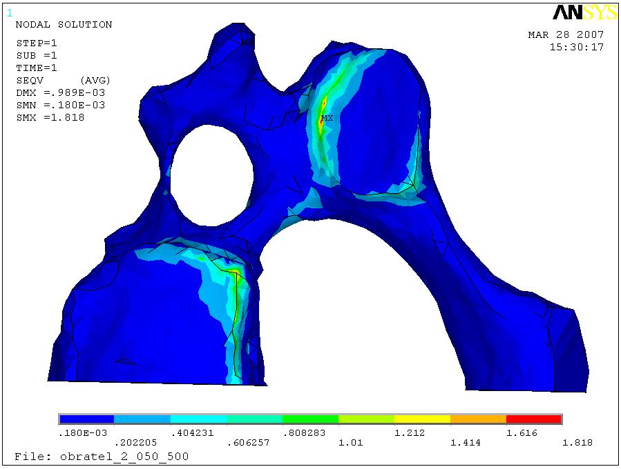 Obrázek 44 - Zobrazení mechanických napětí při zátěţi obratle v neutrálním anatomickém postavení - spodní pohled Rozloţení mechanického stressu ve středním postavení znázorňuje obrázek 44.