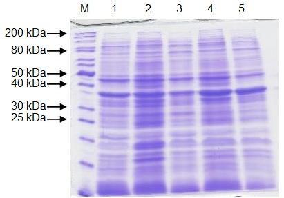 Obr. 12: Analýza lyzátů buněk E. coli BL21(DE3)Rosetta 2 a E. coli BL21(DE3)Star, doba exprese 24 hodin při teplotě 18 C. M marker; 1.