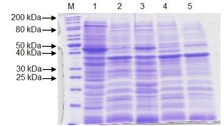 Na gel bylo nabeseno 15 µl vzorku. Obr. 13: Analýza lyzátů buněk E. coli BL21(DE3)Rosetta 2 a E.