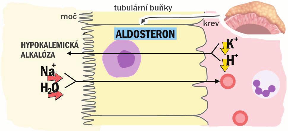 měknutí kostí a příp. osteoporóza, tj. řídnutí kostí).