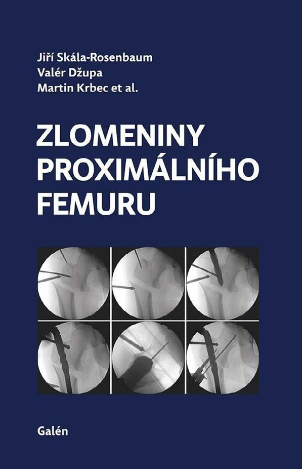 Uvedená kniha spojuje hned několik oborů a prof. MUDr. Oldřich Čech, DrSc. ji ve své předmluvě doporučuje všem odborníkům z řad ortopedů, traumatologů, chirurgů i fyzioterapeutů.