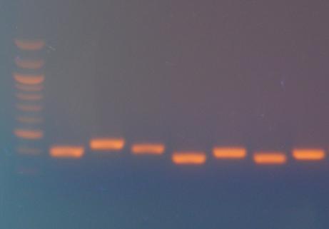 Voigtem 82. Pouţité dvojice primerů jsou uvedeny v kapitole 4.1.1., jejich sekvence v sekci 3.2.4. Připravené produkty byly analyzovány agarosovou elektroforézou.