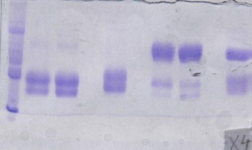 %B nepodařilo. Při gelové chromatografii W1 vyšlo ve dvou elučních vrcholech, z nichţ první odpovídal pravděpodobně dimeru a druhý monomeru.
