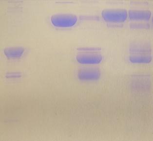 Následně bylo 5 μg všech připravených proteinů smícháno s 1 μl zásobního roztoku 3C proteasy, štěpení probíhalo 16 hod při 4 C a vzorky byly následně analyzovány SDS elektroforézou (Obr. 5.19).