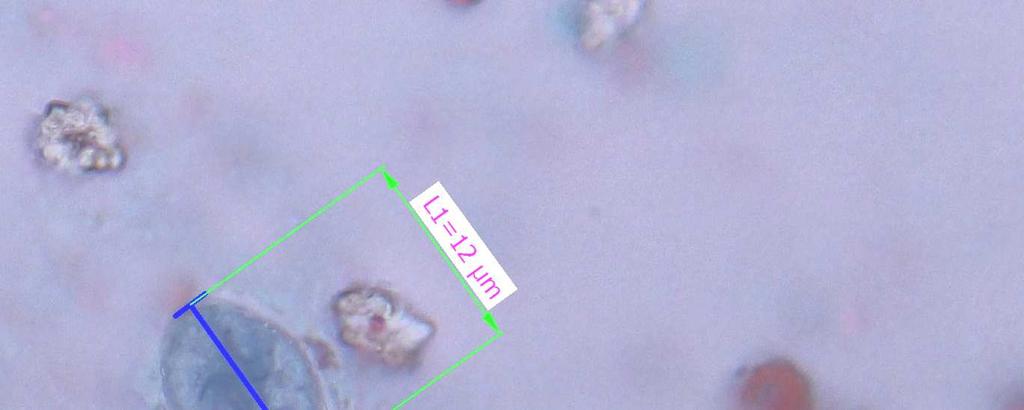 Z 62 laboratoří cysty správně identifikovalo 62 (100 %).