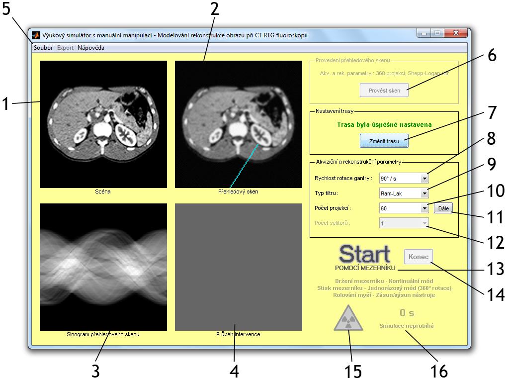 5. Realizace didaktického simulátoru Simulátor je realizován v programovém prostředí MATLAB. Funkce ústředního okna programu jsou uloženy v souboru manualni.m. Simulátor dále využívá několik pomocných funkcí, které se nacházejí v kořenovém adresáři programu.