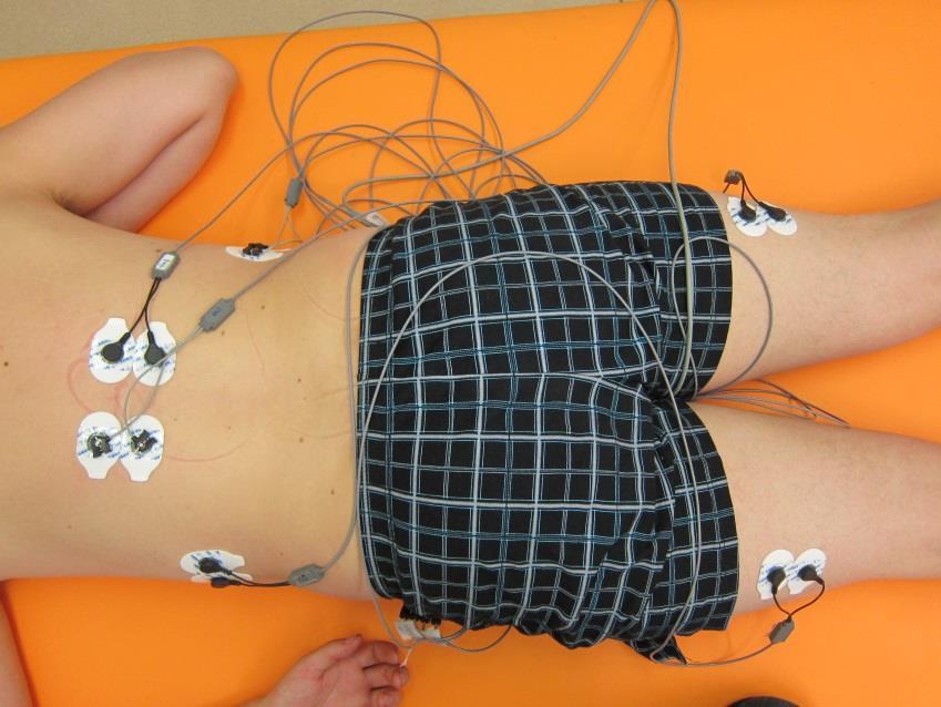 3.2.3.1 Lokalizace a aplikace elektrod Lokalizace elektrod vycházela z lokalizace dle Crama (Criswell, 2011) a shodovala se s přednastaveným zobrazením lokalizace elektrod u jednotlivých svalů v