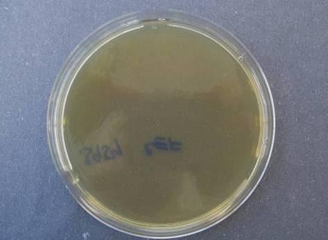 D E F G H I MH agar bez AgNPs (A), MH s obsahem AgNPs o koncentraci 20 mg/l