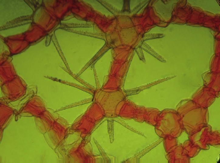 (Poznámka: nezaměňujte trichom opuncie zvaný glochídie a parazitickou larvu škeblí a jiných mlžů, která se jmenuje glochidium.