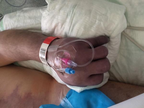 stavy s absolutní či relativní hypovolémií léčit s využitím EGDT (Early Goal-Directed Therapy)
