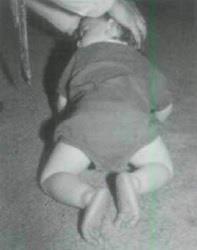 Vojta ve svém článku (1997, 10) uvádí: po celém světě se ještě dnes na všech univerzitách učí, že tonická reflexologie Magnuse a de Kleina patří do reflexologického nálezu novorozence.