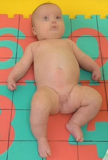 Obrázky 51 a 52. Asymetrické držení těla v poloze na zádech a na břiše Vyšetření č.
