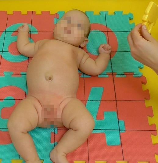 Popis reakce při optické stimulaci hračkou ze strany: fixace pohledem, HKK jsou zapřeny pažemi o podložku u hlavy, ruce sevřeny v pěst, flektované DKK jsou zapřeny patami o podložku (Obrázek 68).