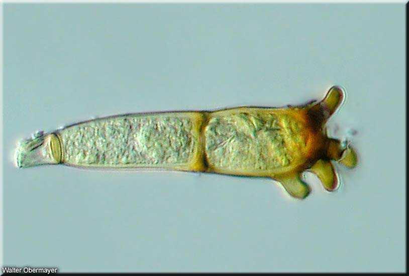 Pucciniomycotina Pucciniomycetes(Urediniomycetes) Pucciniales (Uredinales) - rzi až 5000 druhů parazité cévnatých rostlin,