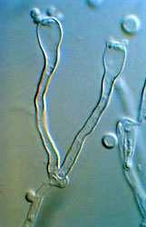 cz/2010/09/cryptococcus-neoformans.