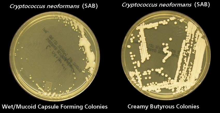 druhu Cryptococcus neoformans významný patogen, původce kryptokokózy (mykóza postihující CNS), u