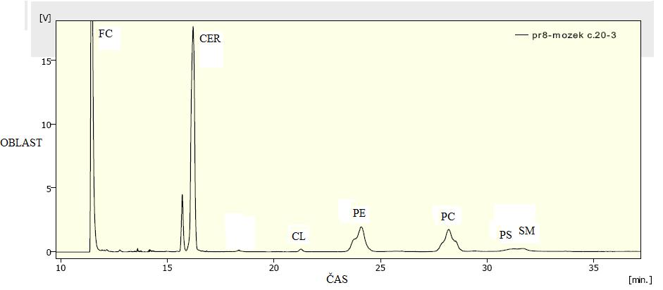 Obr. 52 Analysa lipidů mozkové tkáně myšího mláděte č. 20 metodou HPLC-ELSD Dále jsme pouze informativně analysovali celkový lipidový extrakt směsného lidského krevního séra (Obr. 53).