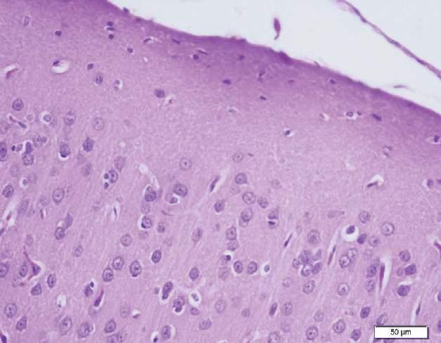 Bulgular Histopatolojik Bulgular: Kontrol grup; beyin dokularının histopatolojik incelenmesinde, normal histolojik görünümde olduğu tespit edildi (Şekil 1). Şekil 1.