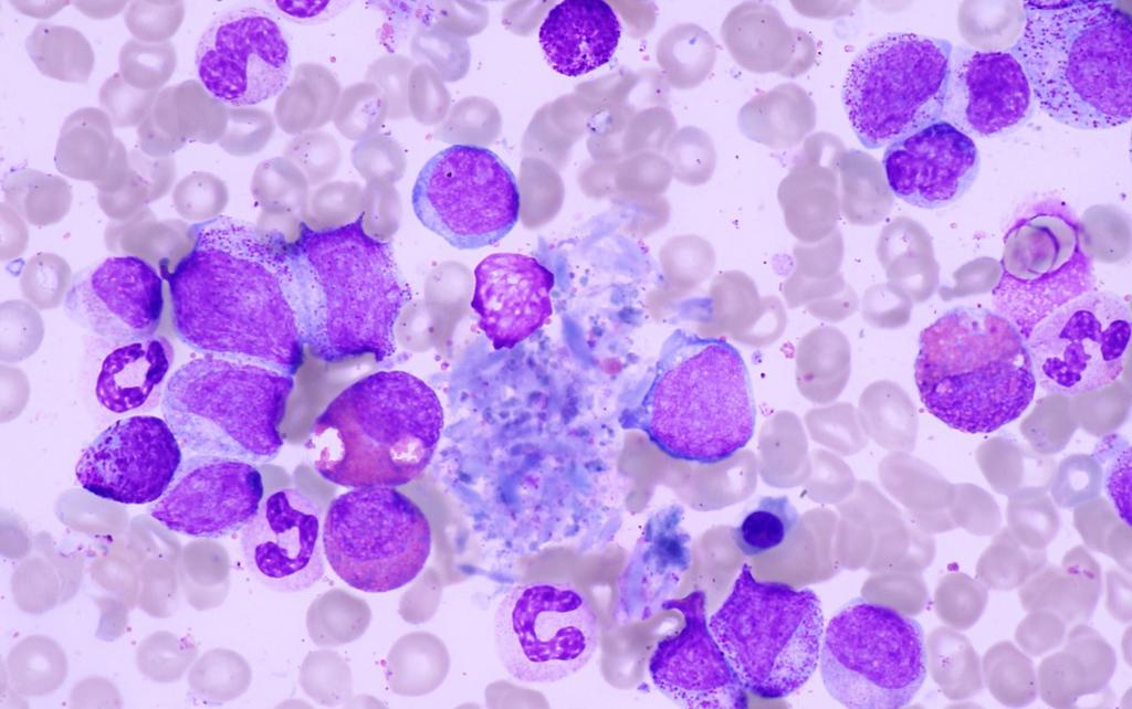 Hematologie 1 Newsletter České hematologické společnosti ČLS JEP 2019 Z obsahu XXXIII.