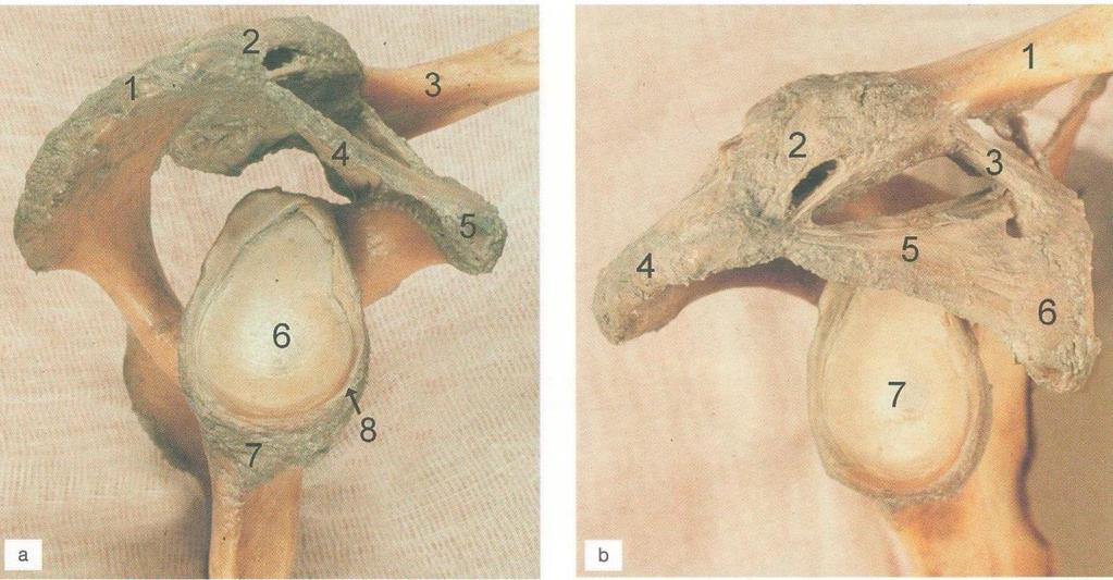 Articulatio humeri (glenohumeralis) 3 Bartoníček J., Heřt, J.