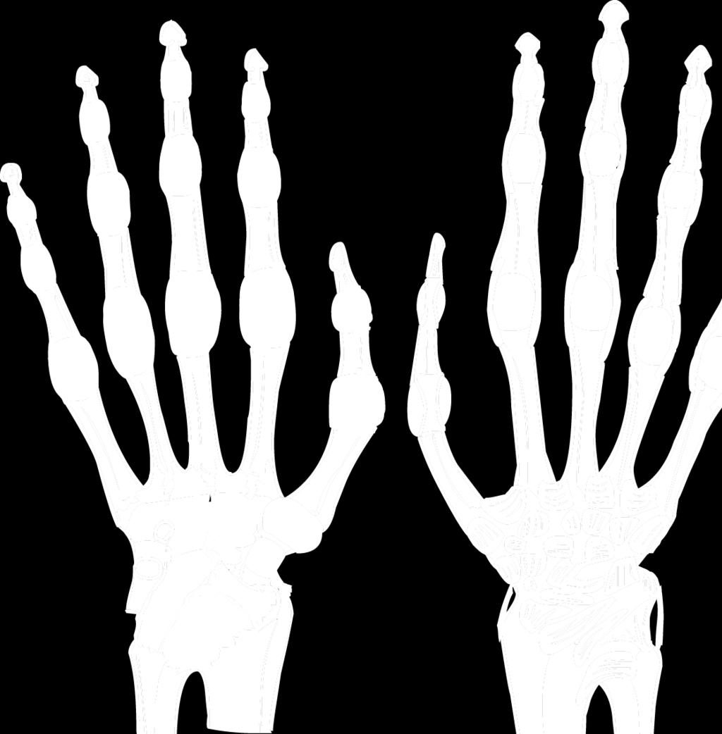 Articulatio radiocarpalis 2 7 Vazy: 7.1 Ligamentum carpi radiatum 7.