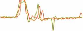 5 RL LL 5 5 75 5 5 75 Left Lateral Samples LP RP 3 3-5 5 75 5 5 75 Left Posterior Samples Head & Eye Velocity - Head & Eye Velocity LA Head & Eye Velocity Head & Eye Velocity.