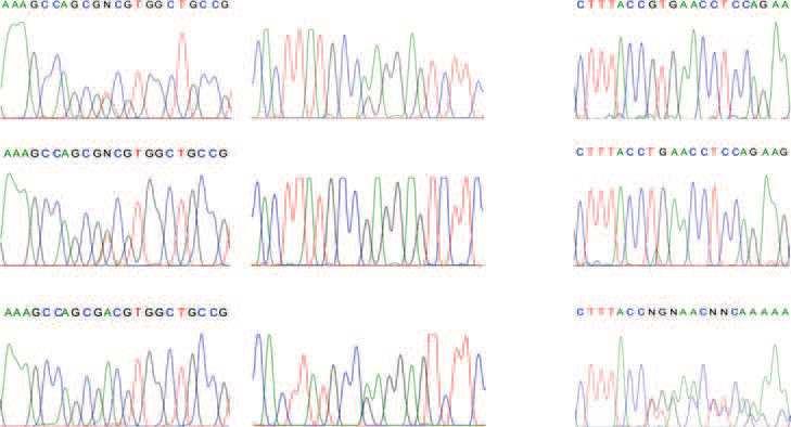 Hepcidin in Pyruvate Kinase Deficiency Table II. Biochemical and molecular data of the patients and their family members.