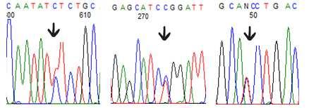 v nep episované γ -UTR oblasti globinového genu (Divoký et al., 1994, Bilgen et al., 2011). Souvislost mezi talasemickým fenotypem a tímto vzácným SNiPem zatím nebyla jednoznačně potvrzena.