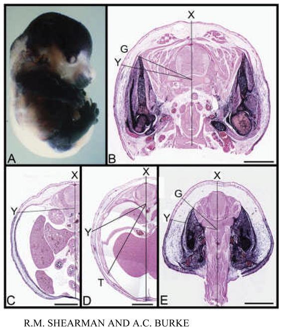 Visualization of the lateral somitic frontier in Prx1 Cre Z/AP mice. Modified from Durland et al. (2008). (A) E15.5 Prx1 Cre Z/AP mouse in whole mount.