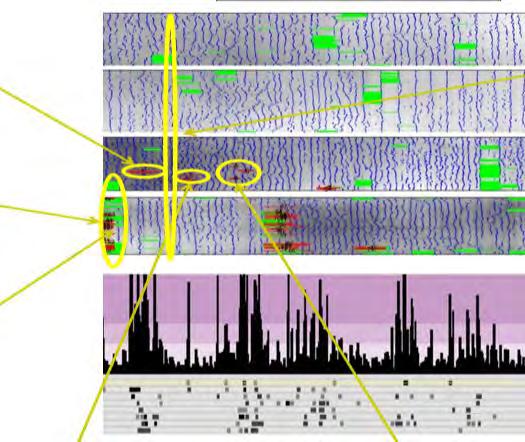 7 Nalezené anomálie, oscilační vrásky a oblasti bez vrásek na sochoru pomocí algoritmu vyvinutého v prostředí MATLAB Anomalies, oscillation marks and areas without oscillation marks found on the