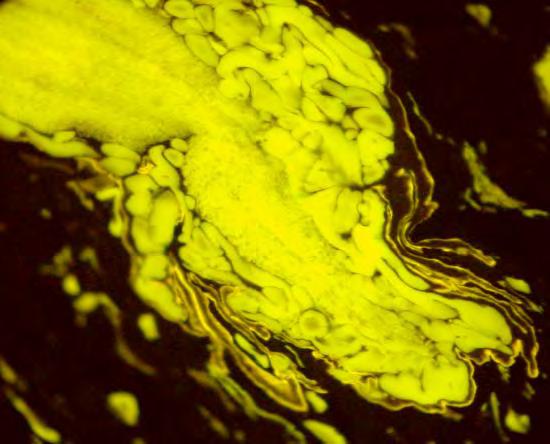 ISSN 0018-8069 Liptinite due to its high volatile matter content, influences coke porosity.
