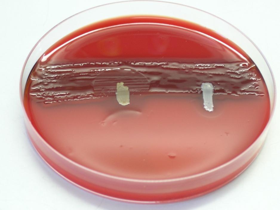 JEDNODUCHÝ TEST K ODLIŠENÍ KMENŮ S. aureus : Průkaz hyaluronidázy (dekapsulační test) s kmenem Streptococcus equi subsp.