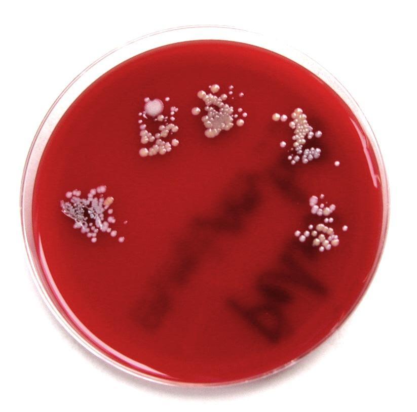 4. Stafylokoky koaguláza-negativní (KNS) nejběžnější součást kožní mikroflóry S. epidermidis S. haemolyticus S.