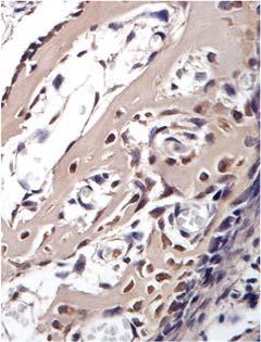 Obrázek 1: Imunohistochemická detekce proteinu Myb během prenatálního vývoje (E embryonální den 13, 14, F -