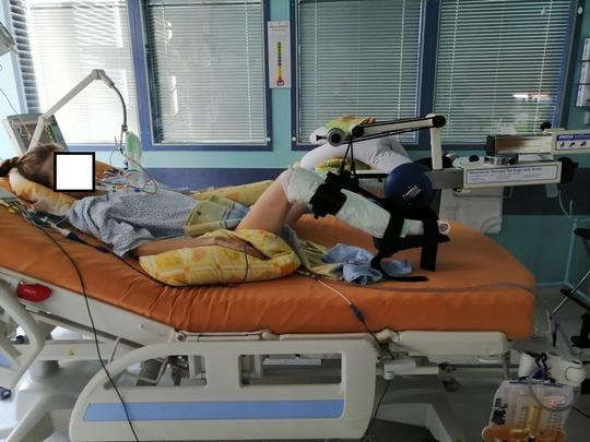 FYZIOTERAPIE Motomed k prokrvení fetoplacentárního oběhu Podpora peristaltiky