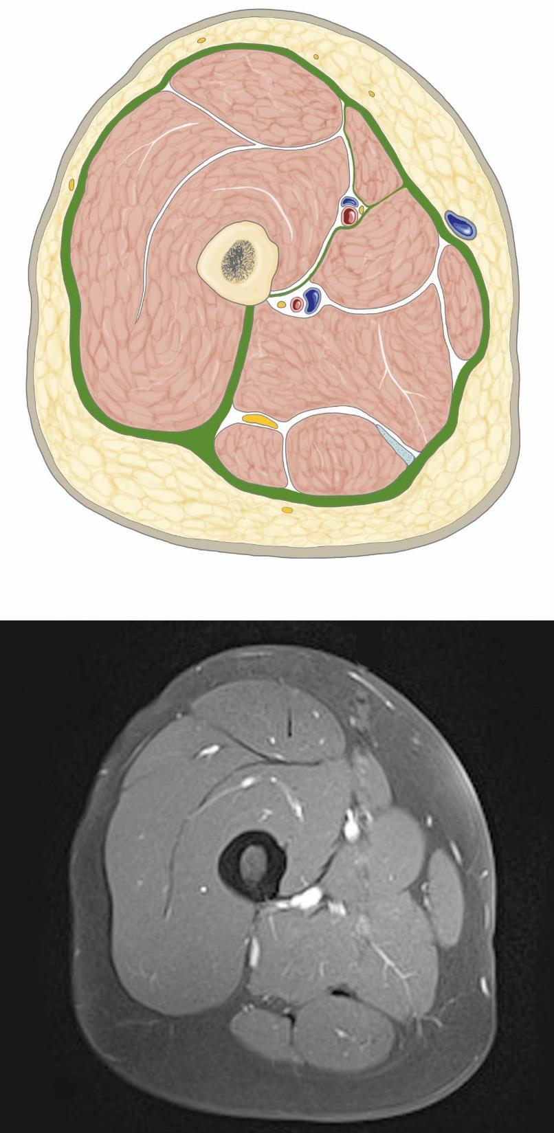 Grim, Naňka, Helekal: Atlas Anatomie